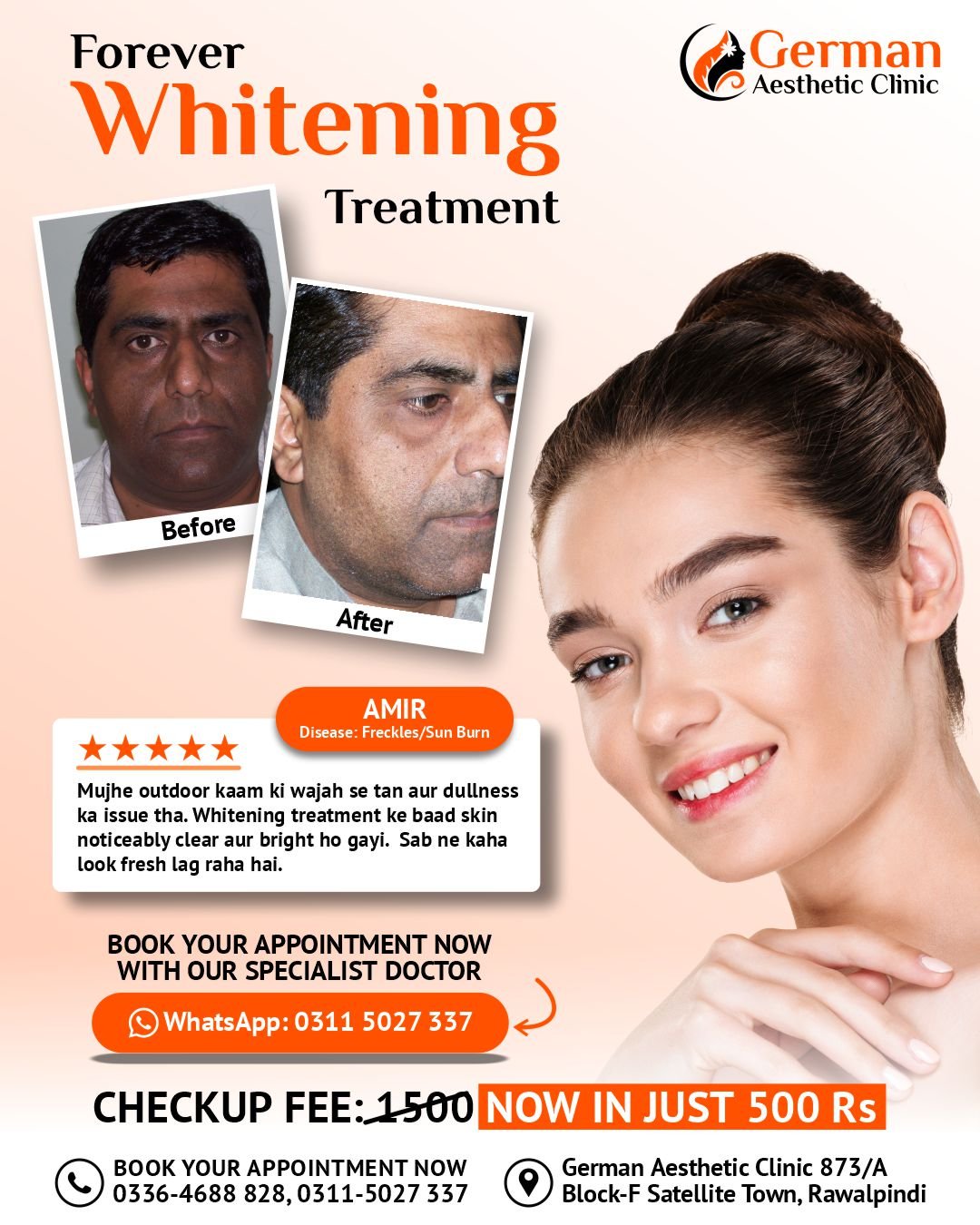 Forever Whitening Treatment